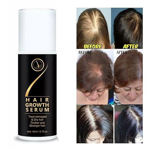 Hair Growth Serum (Roll On) | Treat Damaged & Dry hair into Thicker and Stronger