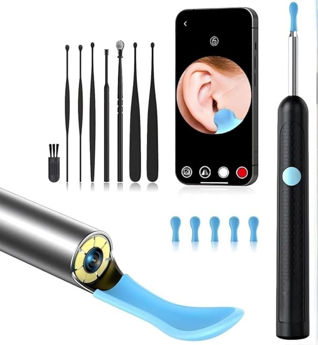 Pro Visual Earwax Cleaner – Smart Otoscope with Ear Wax Removal Kit