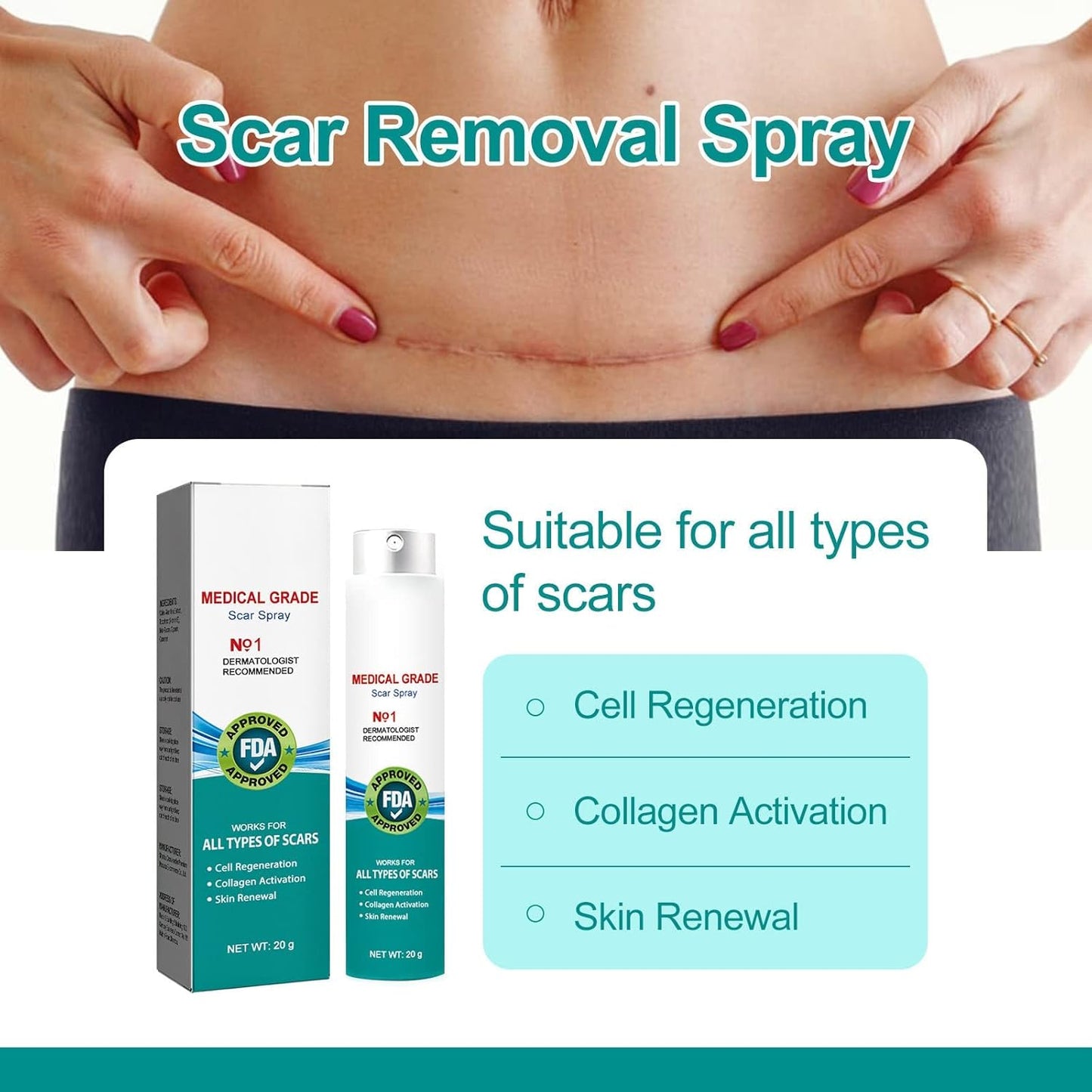 South Moon Scar Removal Spray (Pack Of 2)